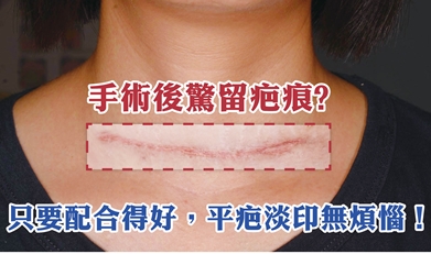 手術後驚留疤痕？只要配合配得好，平疤淡印無煩惱！