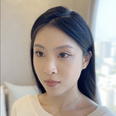 Alyssa Beauty 推薦 | 麗珠蘭完全取代精靈針？